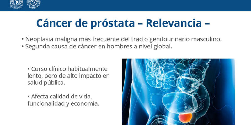 dia-del-cancer-de-prostata:-mexicanos-se-resisten-a-acudir-al-medico